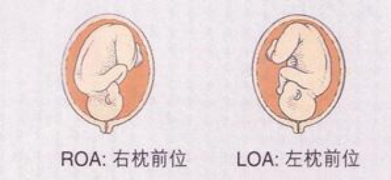 loa胎位图是什么意思呢