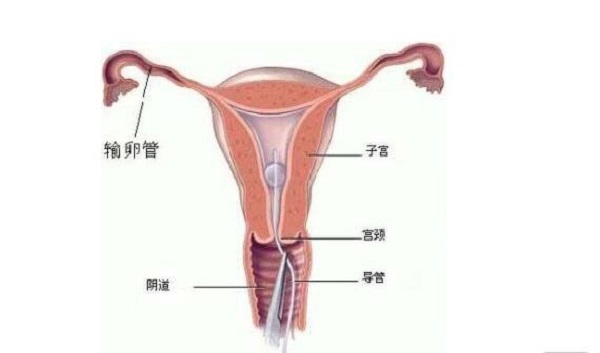 左右双侧输卵管都切除了，现在想怀孕还可以吗？