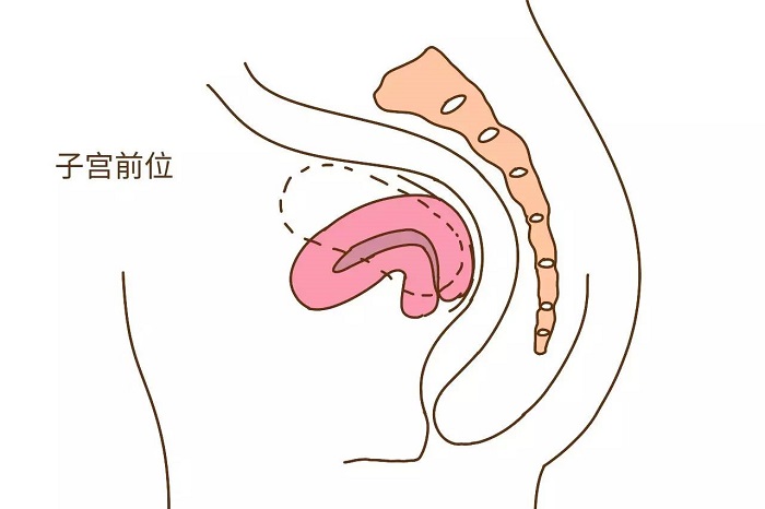 子宫前位的受孕姿势图片