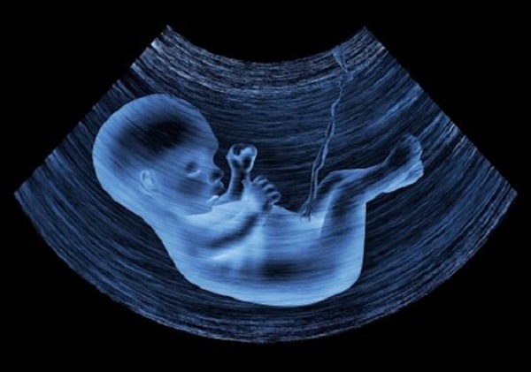 胎儿性别发育图图片