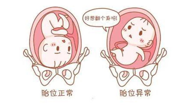 胎儿正枕前位示意图图片