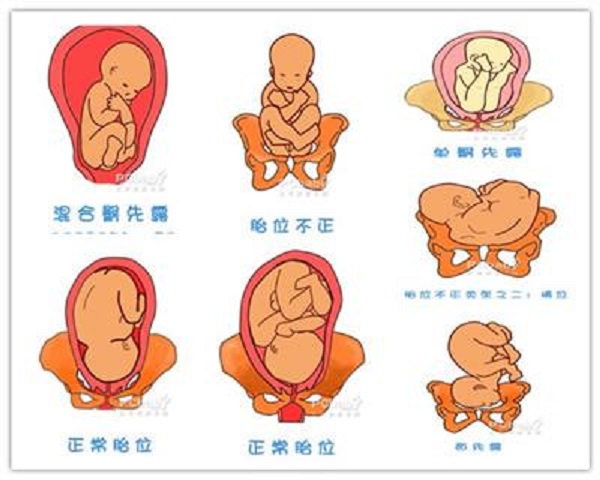不同月份胎位图图片