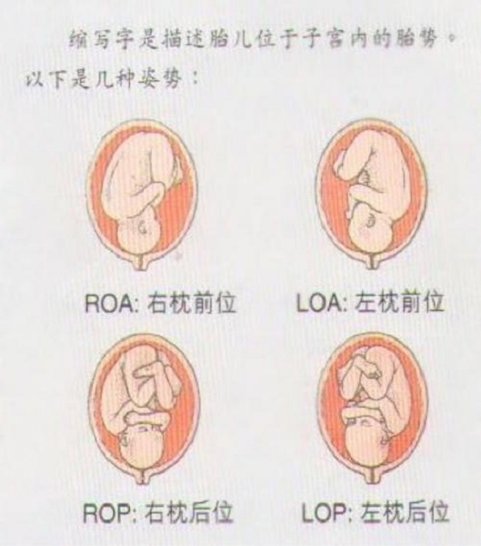 左骶前胎位图片