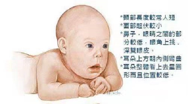 婴儿特殊面容图片